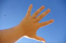 R***r