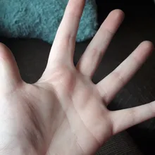 A***s