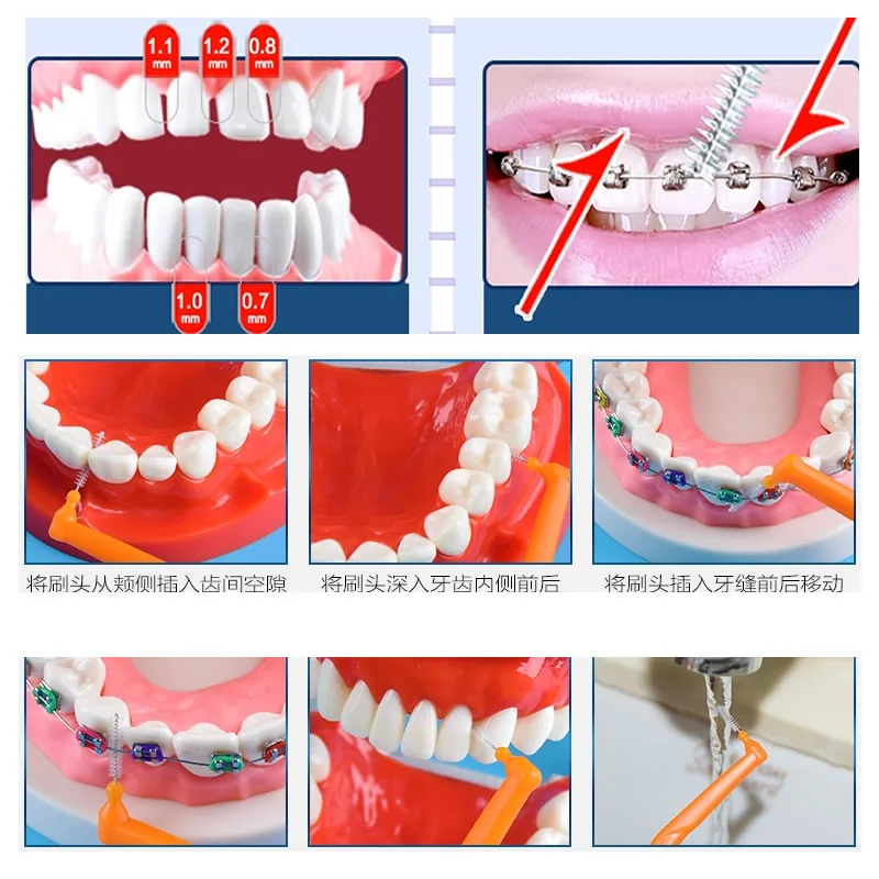 Межзубная шунт щеток l-типа межзубная коррекция зубной щетки Ортодонтическая узкая щетка 30 шт