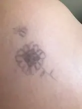 S***N