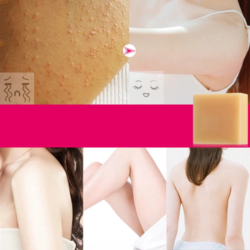 

Chicken Skin Remover Chamomile Soothing Soap Body Exfoliator Cleanser Skin Care Oil Control Deep Cleansing Whitening Beauty Care