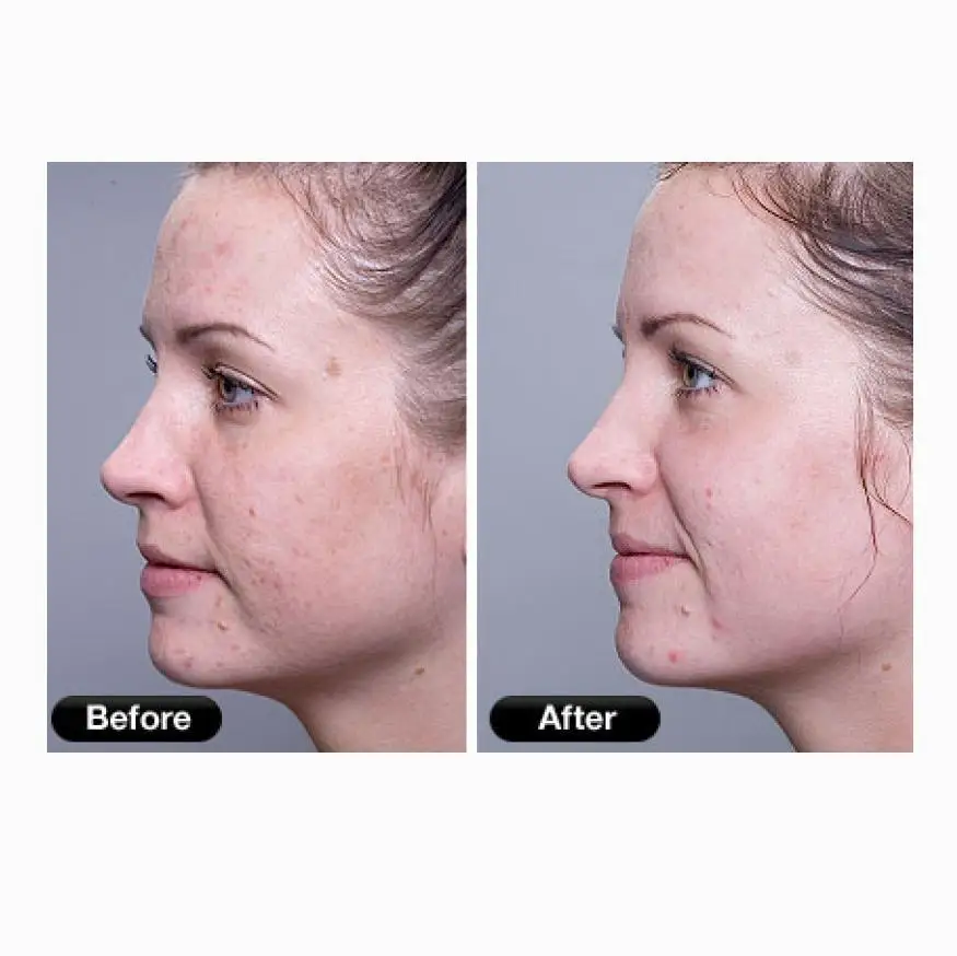 inspire-uplift-spa-mask-led-spa-facial-mask-1411868459019_1000x