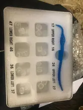 Kit de molde de impresión Dental Posterior, herramientas de llenado de restauración Dental