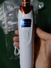 Limpiador de poros y espinillas por succión al vacío, eliminador de espinillas, Zona T, acné del poro, succión al vacío, cabeza negra, belleza, limpieza de la piel