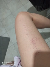 Eléctrica de las tazas masaje pantalla LCD raspado Guasha EMS masajeador del cuerpo de latas de la succión de la Copa IR calefacción quemador de grasa adelgazar