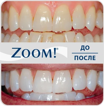 

Отбеливание ZOOM