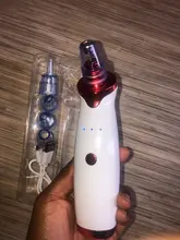 Aparato para limpieza profunda de la piel con espinillas, limpiador con punta de diamante de Zona T para nariz y resto del rostro, para la eliminación de espinillas, succión al vacío
