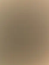 Kit de eliminación de verrugas y microbanda para la piel, eliminador de verrugas con hisopo de limpieza, topos y verrugas para adultos, cuidado facial