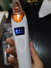 Limpiador de poros y espinillas por succión al vacío, eliminador de espinillas, Zona T, acné del poro, succión al vacío, cabeza negra, belleza, limpieza de la piel