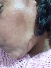 Crema facial antimanchas para hombres y mujeres, crema hidratante para la piel, reafirmante, elimina pecas y acné, pigmento, melanina