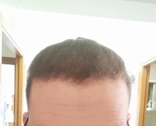 Aplicador de queratina para la pérdida del cabello, polvos de fibra de construcción para el crecimiento del cabello, Spray de estilismo, extensión de polvo de Color para adelgazamiento