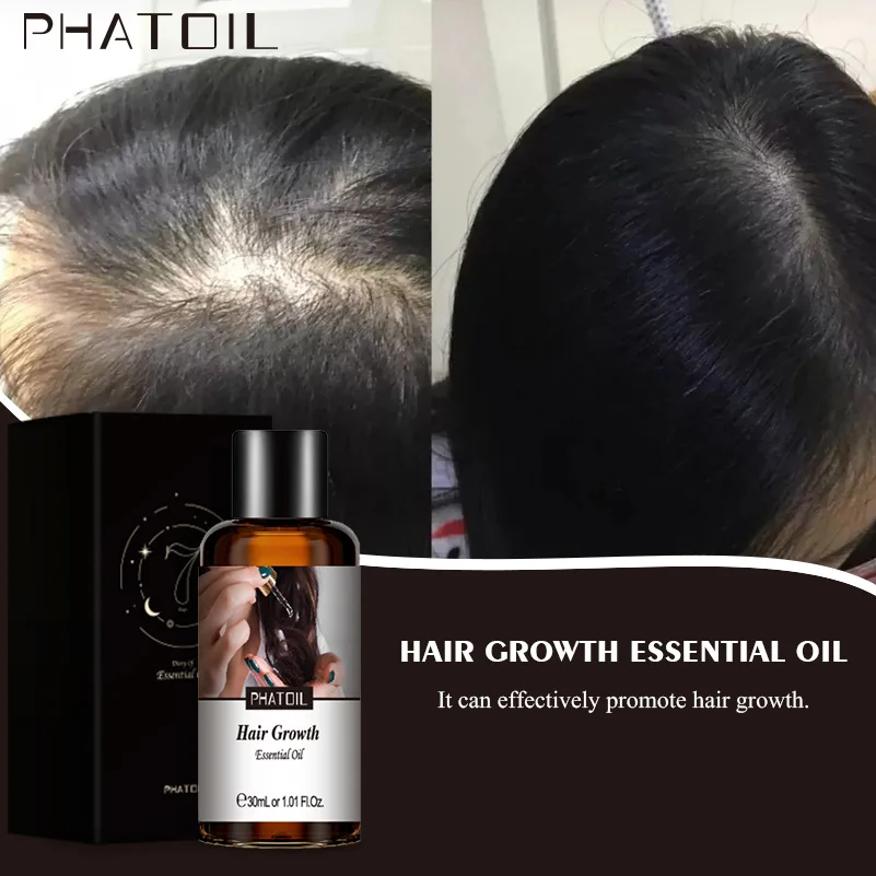 

1.01oz Functional Fragrance Oil Skin Care Dark Spots Remove Acne Burn Stretch Marks Scar Removal Compound Essential Oil 30ml