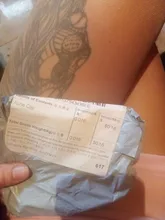 Extractor De espinillas De cavo, juego De agujas para eliminar acné, corrector De puntos negros y oro rosa, herramienta limpiadora De poros