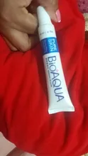 Bioaqua-Control de aceite de crema antiacné, 30g, reducción de acné y poros, elimina cicatrices, cuidado facial, SCI88