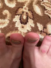 12 Uds encarnada del dedo del pie fijador de alambre para corrección de uñas pedicura paroniquia recuperar Corrector de uñas de pie de cuidado de los pies herramienta