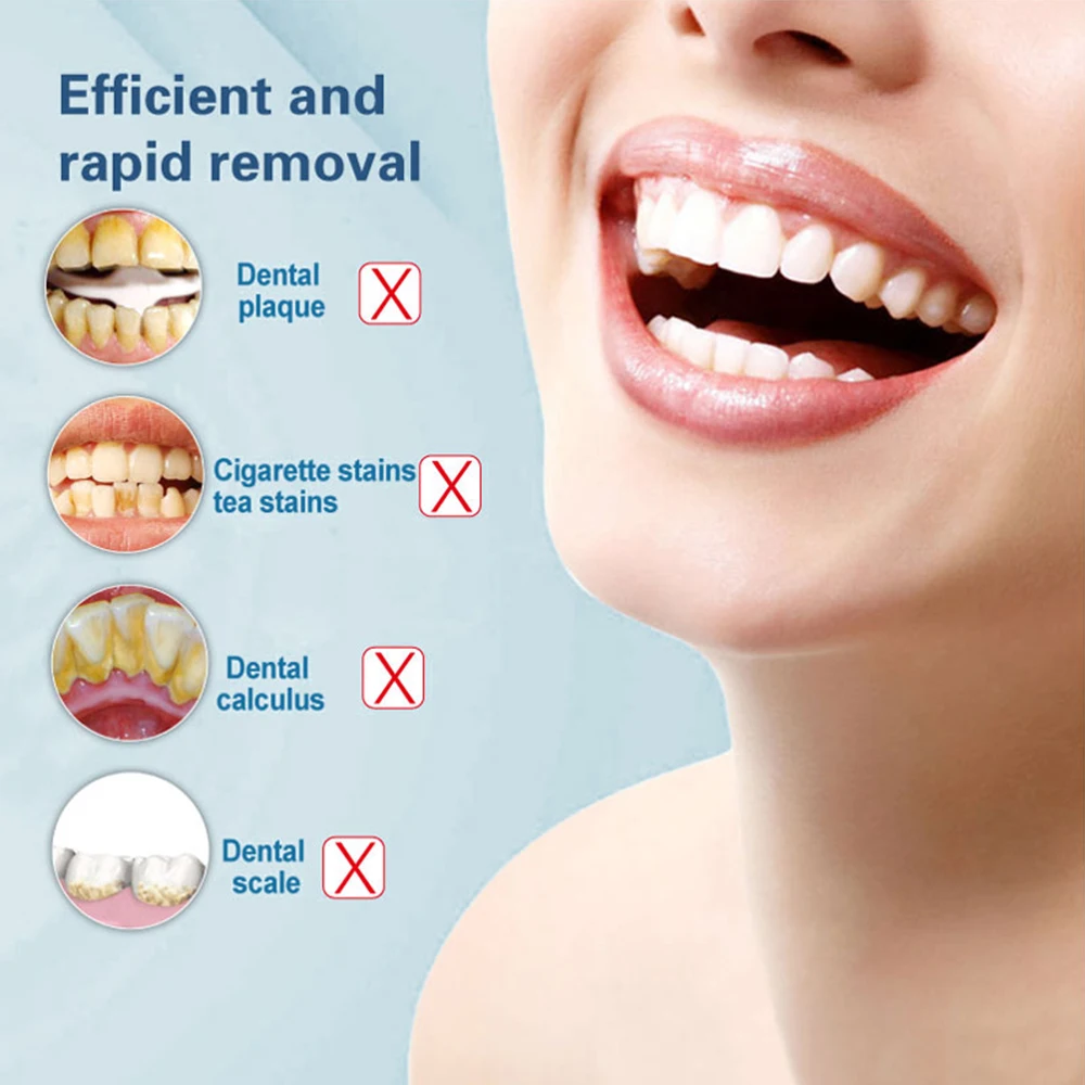 Electric Ultrasonic Dental Scaler Teethbrush Tooth Calculus Remover Cleaner Tooth Stains Tartar Tool with 5 Replaceable Heads Electric Ultrasonic Dental Scaler Teethbrush Tooth Calculus Remover Cleaner Tooth Stains Tartar Tool with 5 Replaceable Heads