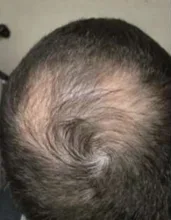 Champú y acondicionador para el crecimiento del cabello con queratina brasileña, conjunto para mejorar el crecimiento del cabello, regalos, previene el cuidado de las mujeres de 200ml
