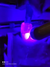 Kit de molde de impresión Dental Posterior, herramientas de llenado de restauración Dental