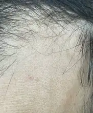 Suero para el crecimiento del cabello de jengibre, tratamiento para la pérdida del cabello con Spray, aceite esencial para el crecimiento del cabello Germinal efectivo en 7 días, cuidado del cabello para hombres y mujeres, 30ml