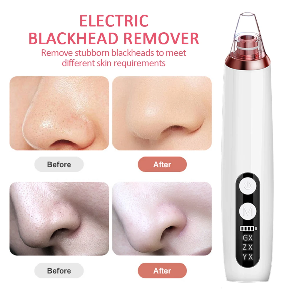 476958_2_3cc966499d514310988b91e9de76b67f