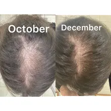 Hair-Growth-Essence Spray-Stop Liquid Damaged-Treatment Help Woman Fast HAIRCUBE 