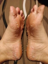 Aloe Vera máscara pelar para las piernas pies máscara exfoliante calcetines exfoliantes pedicura Anti grieta de talón eliminar parche de pie