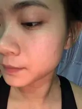 Crema blanqueadora para pecas, crema facial de hierbas chinas, elimina pecas y manchas oscuras, 30g