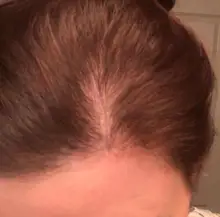 Champú para el crecimiento del cabello para hombres y mujeres, conjunto de regalo, espesante, productos para el cuidado de la caída del cabello, tratamiento de crecimiento del cabello, aceite SÉRUM