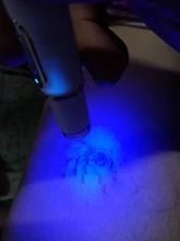 Lápiz láser para tratamiento de venas varicosas, lápiz láser para tratamiento de eliminación de cicatrices, arrugas, acné, masaje relajante