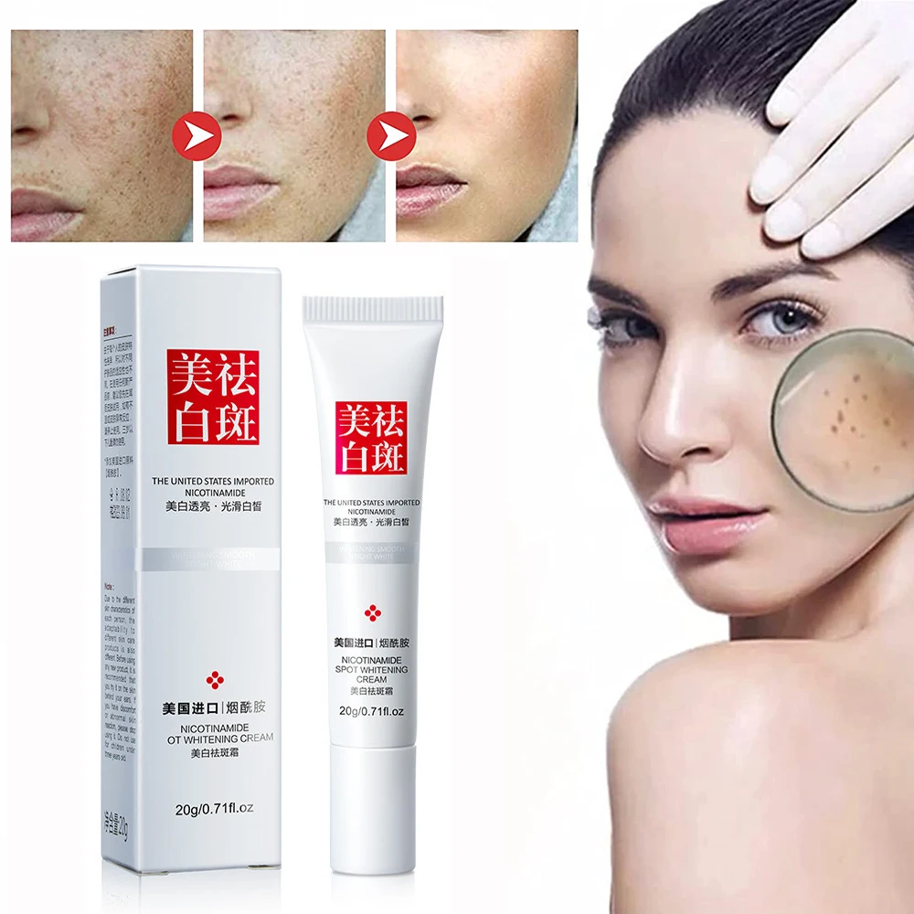 Whitening Freckle Cream Remove Melasma Acne Spot Pigment Melanin Dark Spots Pigmentation Freckle Removal Cream Moisturizing Gel
