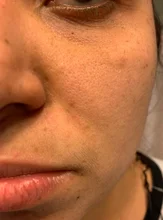 Suero facial con ampolla de vitamina C, blanqueador, antiarrugas, hidratante, reduce los poros, repara el cuidado de la piel facial