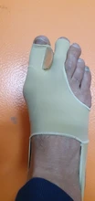 Pedicure-Tool Bunion-Corrector Toe-Separator Thumb-Straightener Hallux-Valgus Orthosis