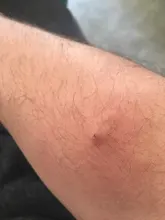 160 unids/lote banda Simple ayuda transparente impermeable y transpirable hemostática heridas vendaje adhesivo de primeros auxilios Kit de emergencia