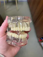 Modelo de dientes para implante Dental, modelo transparente para dentistas, estudiantes de aprendizaje, enseñanza, comunicación de investigación