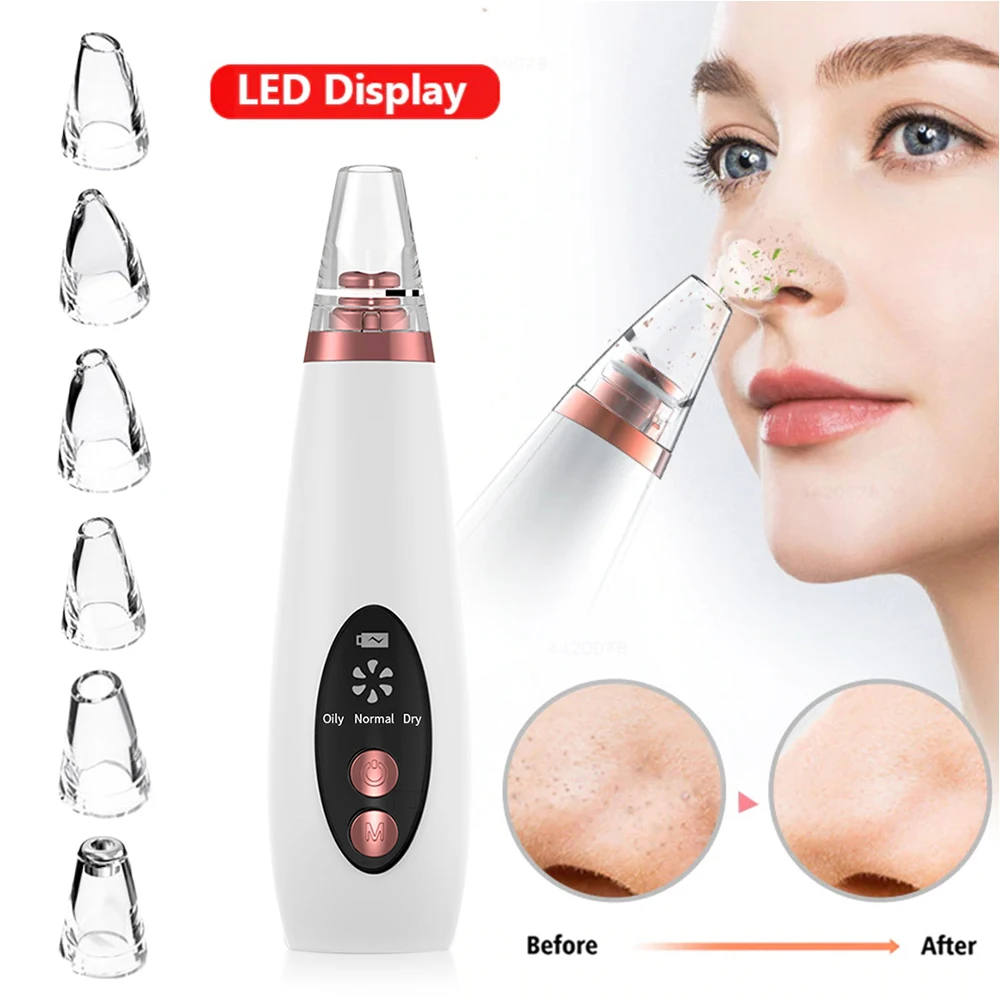 

USB Rechargeable Blackhead Remover Face Pore Vacuum Skin Care Acne Pore Cleaner Pimple Removal Vacuum Suction Facial Tools