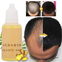 Средство для роста волос выпадение волос жидкость натуральный чистый эфирные масла плотная Сыворотка от выпадения волос забота о здоровье красота