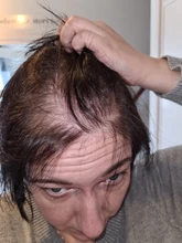 Aplicador de queratina para la pérdida del cabello, polvos de fibra de construcción para el crecimiento del cabello, Spray de estilismo, extensión de polvo de Color para adelgazamiento