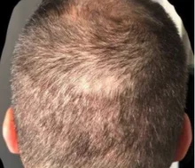 Champú y acondicionador para el crecimiento del cabello con queratina brasileña, conjunto para mejorar el crecimiento del cabello, regalos, previene el cuidado de las mujeres de 200ml