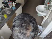 Fibras de reconstrucción del cabello, productos contra la caída del cabello más gruesos de queratina, corrector de relleno, polvos de fibra espesante para el crecimiento del cabello, sevich 25g