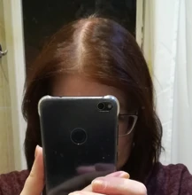 Fibras de reconstrucción del cabello, productos contra la caída del cabello más gruesos de queratina, corrector de relleno, polvos de fibra espesante para el crecimiento del cabello, sevich 25g