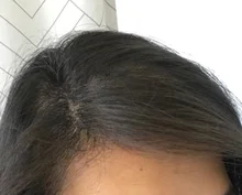 HAIRCUBE-esencia para el crecimiento del cabello para hombres y mujeres, suero para el crecimiento del cabello, Germinal rápido, cuidado del cabello, reparación, líquido antipérdida de cabello más grueso