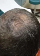 Champú y acondicionador para el crecimiento del cabello con queratina brasileña, conjunto para mejorar el crecimiento del cabello, regalos, previene el cuidado de las mujeres de 200ml