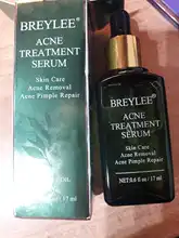 BREYLEE-suero para el tratamiento del acné Facial, producto para el cuidado de la piel, eliminación de cicatrices, granos, blanqueamiento y acné