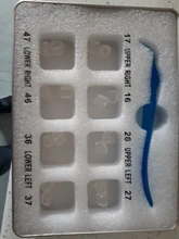 Kit de molde de impresión Dental Posterior, herramientas de llenado de restauración Dental