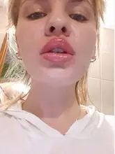 Ácido Hialurónico labial de 2ml, potenciador de los labios HA reticulado, para pluma de hialurón con caja, 2021