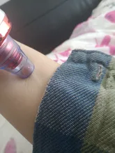 Limpiador eléctrico de acné y puntos negros, herramienta de limpieza al vacío para puntos negros y acné