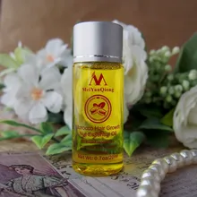 Esencia rápida y potente para el crecimiento del cabello, productos para la pérdida del cabello, tratamiento líquido de aceite esencial, productos para el cuidado del cabello, 20ml