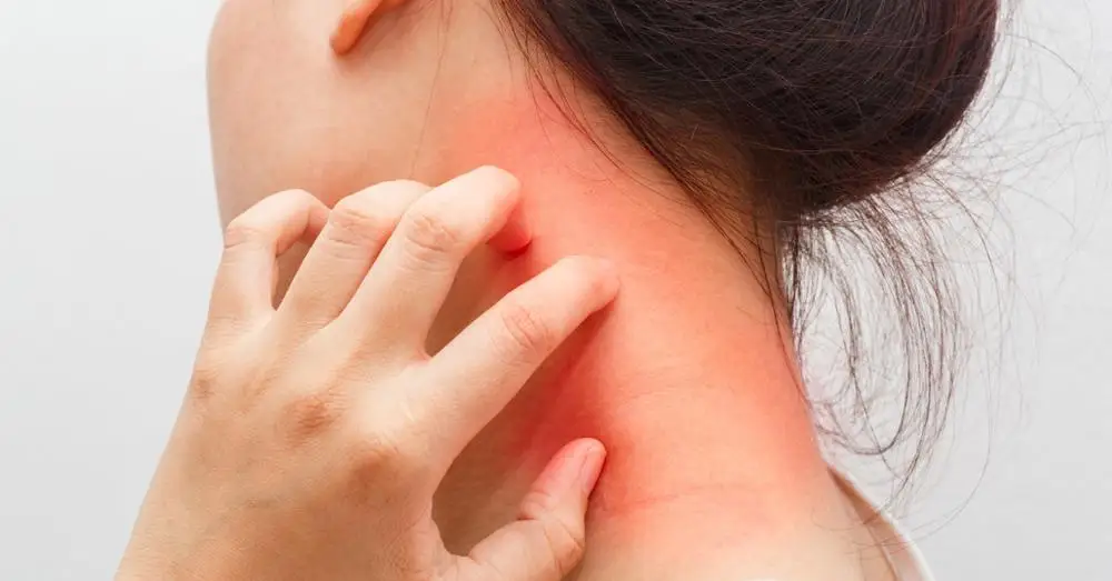 Bepanthen Sensiderm крем 20/50 г сухая кожа атопический дерматит экзема аллергическая