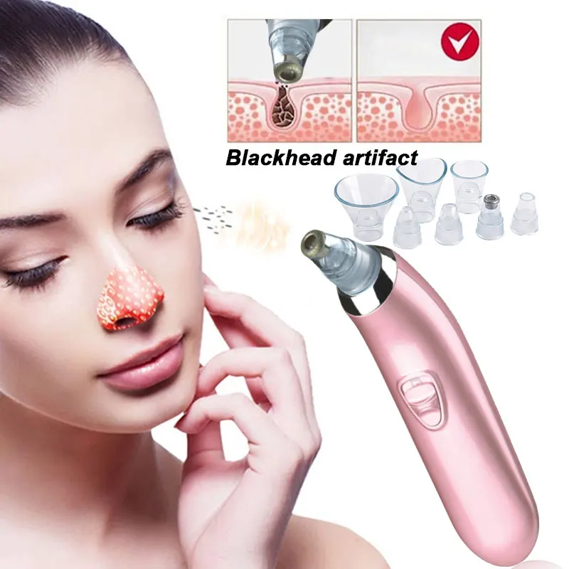 Волшебное средство для удаления угрей и поры уменьшения жирности красоты 7