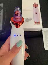 Aparato para limpieza profunda de la piel con espinillas, limpiador con punta de diamante de Zona T para nariz y resto del rostro, para la eliminación de espinillas, succión al vacío